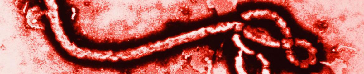 Picture of Ebola virus